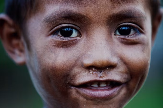Timor-Leste confidenziale